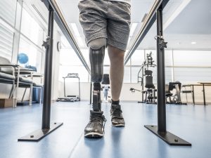 A man in rehabilitation with a prosthetic leg.